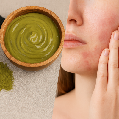 Coloration naturelle et allergie : comment éviter les réactions cutanées ?
